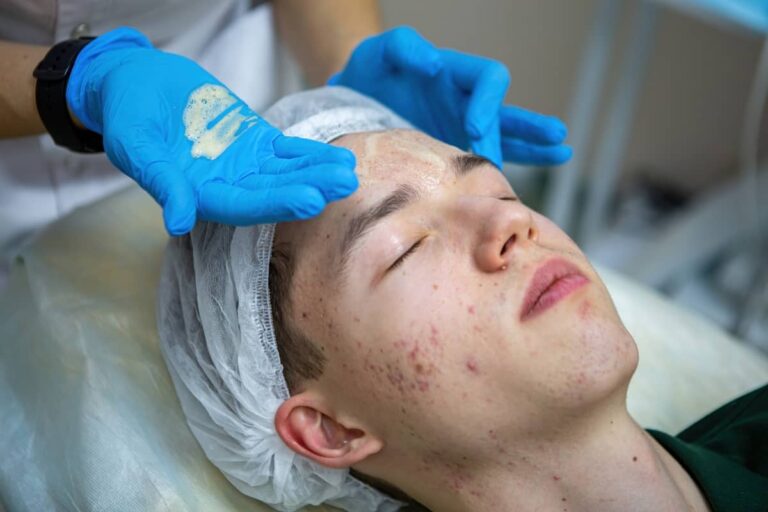 Ranking Kosmetyków do Cery Trądzikowej dla Nastolatków