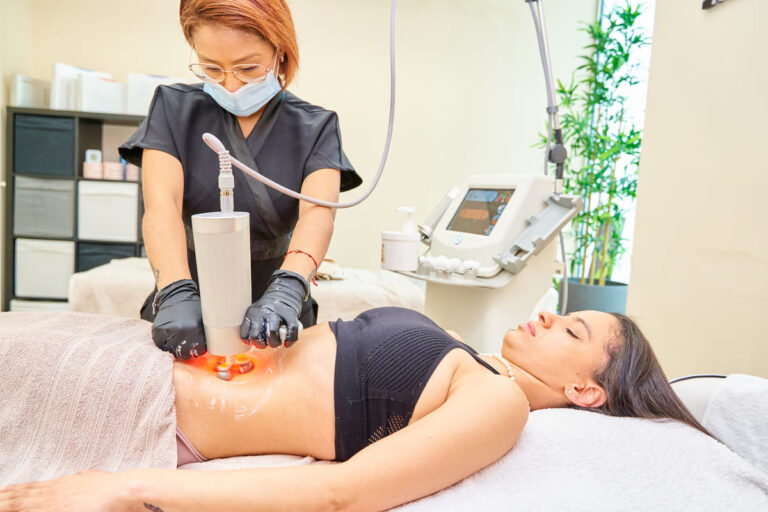 4 najlepsze zabiegi wyszczuplające brzuch